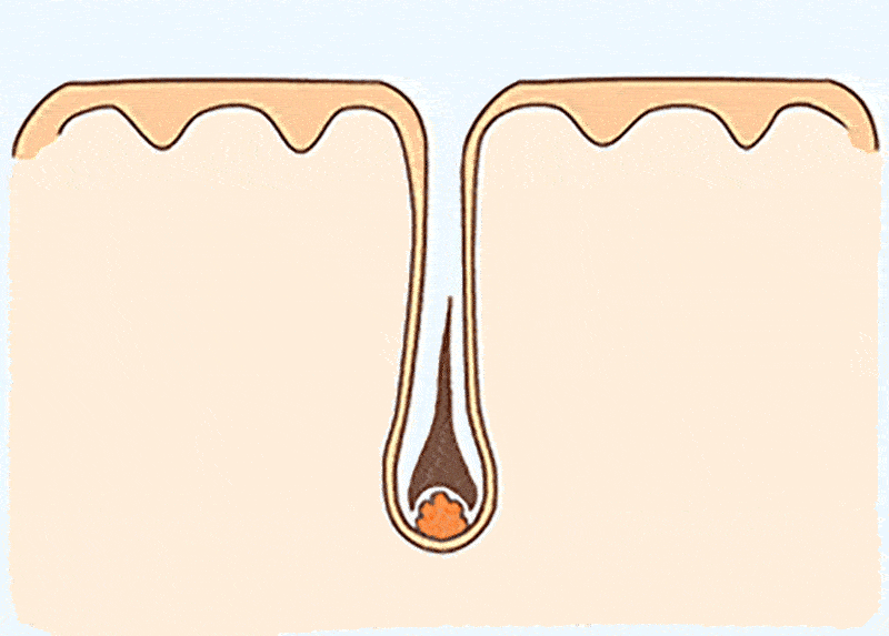 12.gif