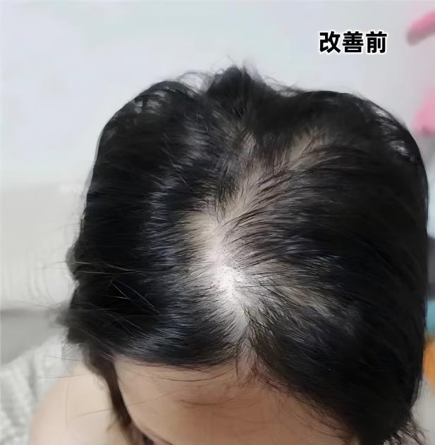 （听大家说241210大玉儿用）7.19防脱通用1-2.jpg