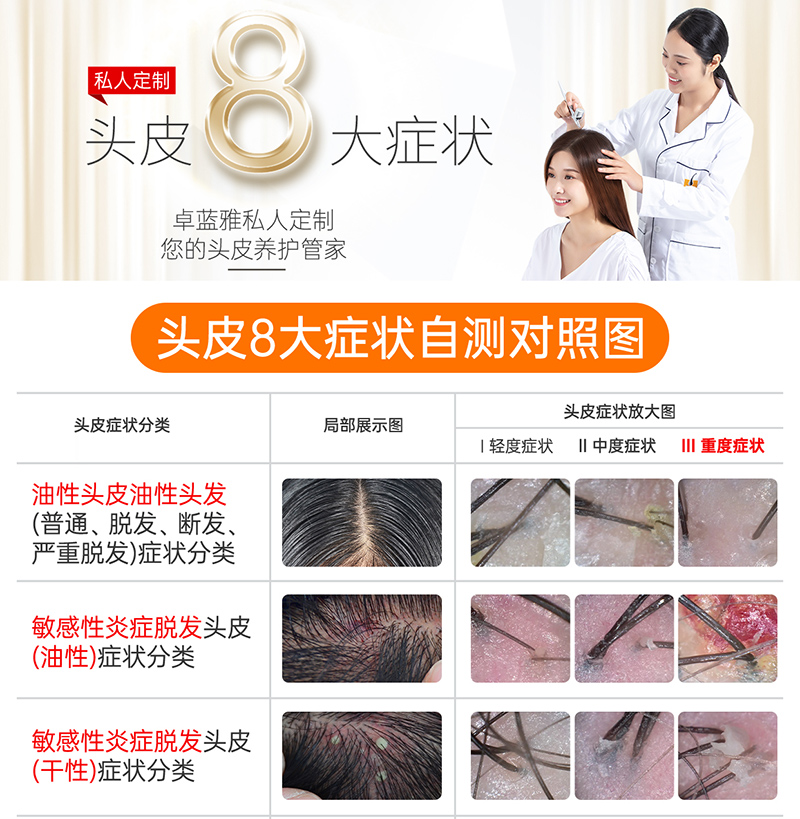 卓蓝雅头皮八大症状自测对照图_01.jpg