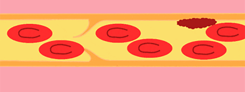 1691655104300735.gif 2.gif