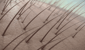 1.gif