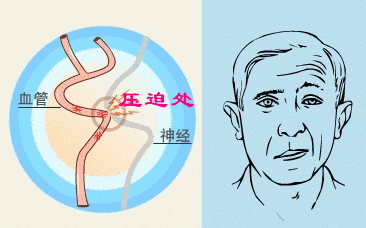 4.gif