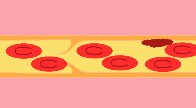 03.gif