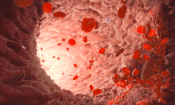03.gif