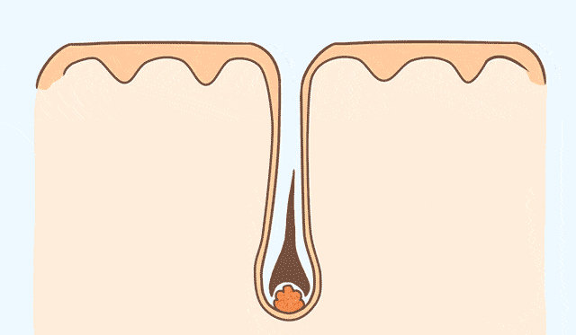 04.gif