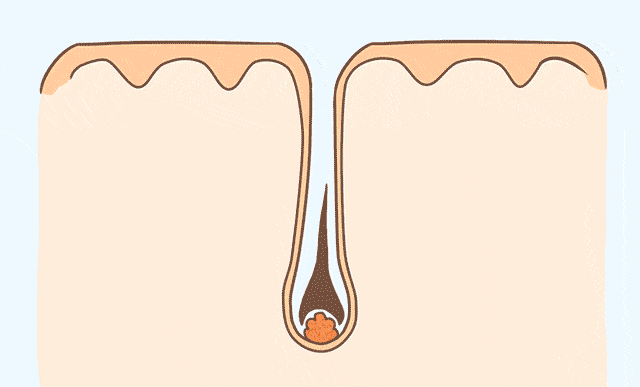 02.gif